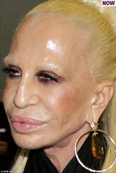 versace botox|donatella versace botox.